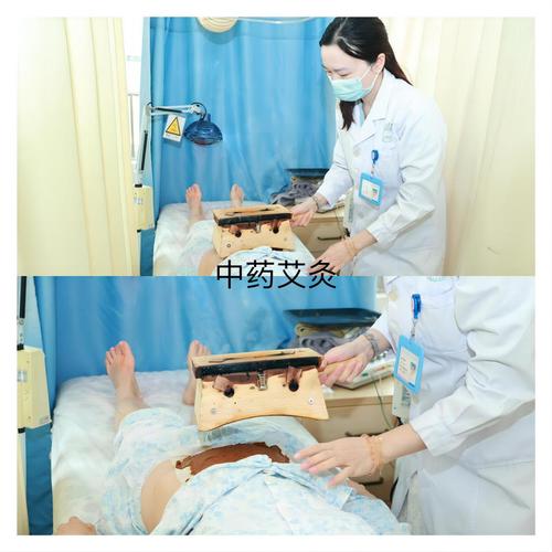 针灸对卵泡发育有用吗