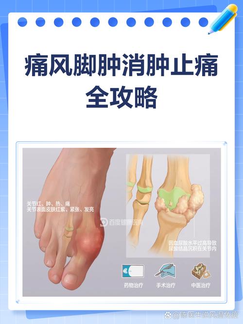 痛风什么方法可以治疗