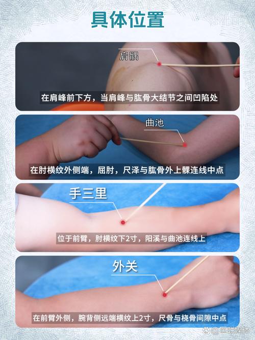 针灸后胳膊胀痛怎么办