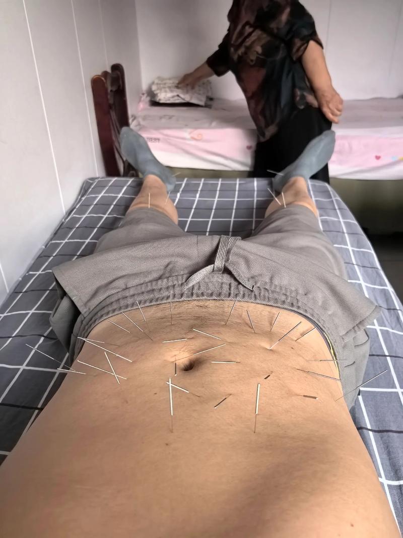 拉肚子针灸效果怎么样