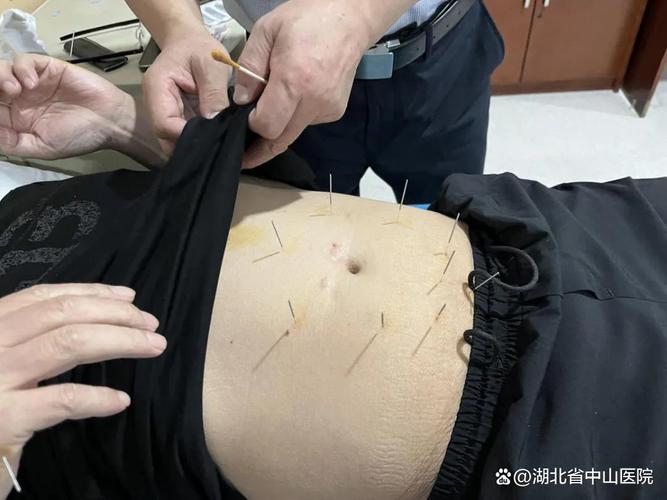 大屁股上扎针灸的视频