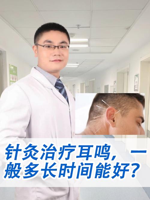 针灸治好了神经性耳鸣