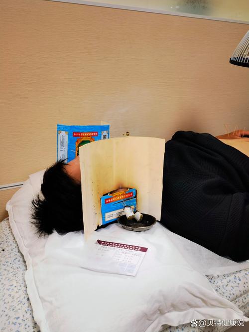 针灸治好了神经性耳鸣