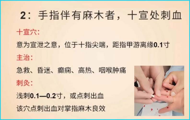 针灸后手肿了怎么回事