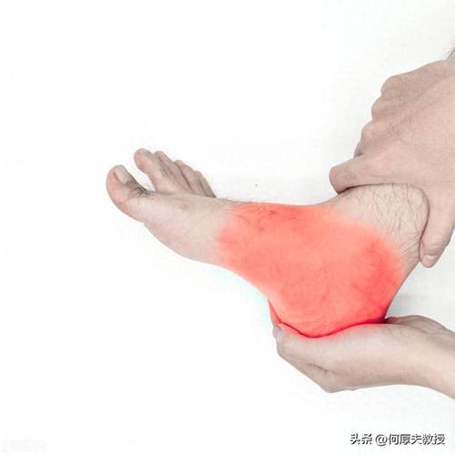 痛风是在脚的哪个位置