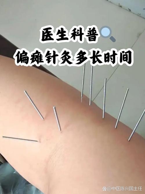 针灸治什么病最有效果