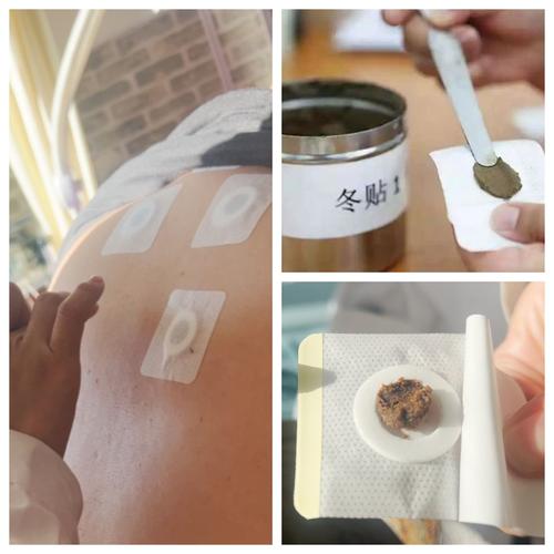 针灸贴男人帮效果好吗