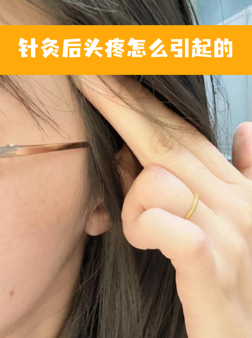 为什么针灸后更加酸痛