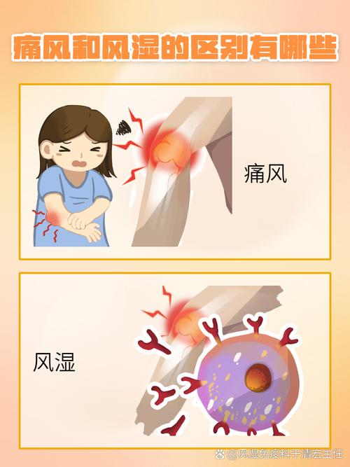 类风湿与痛风有啥区别