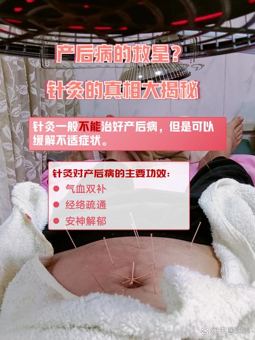 哺乳期为什么不能针灸