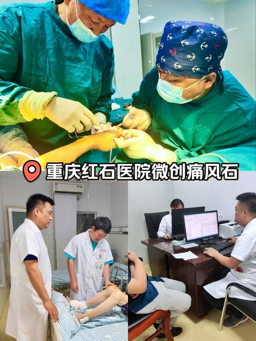 治疗痛风的医院在哪里