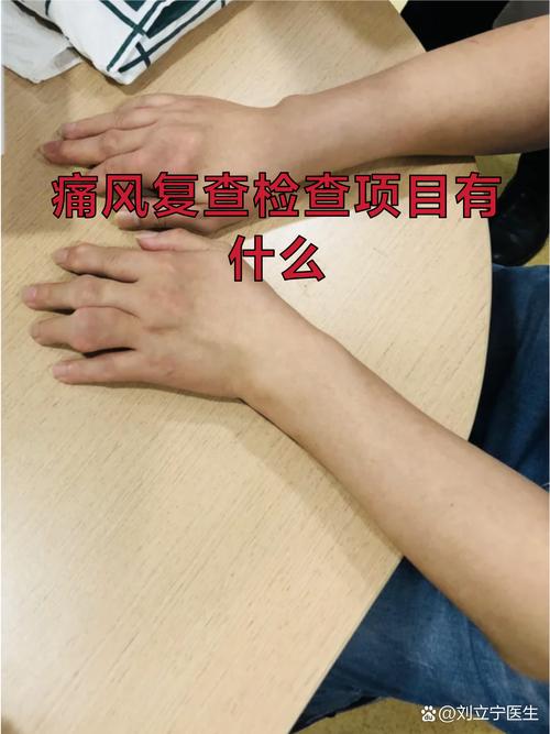 痛风要做什么检查什么