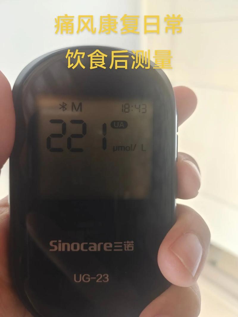 痛风的检查需要空腹吗