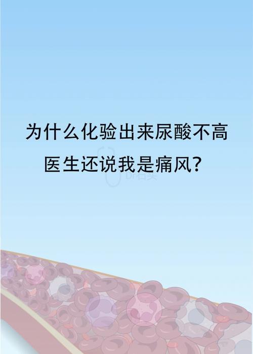 尿酸不高为什么还痛风