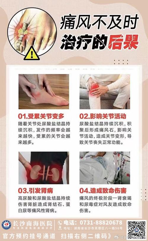 痛风的治疗需要住院吗