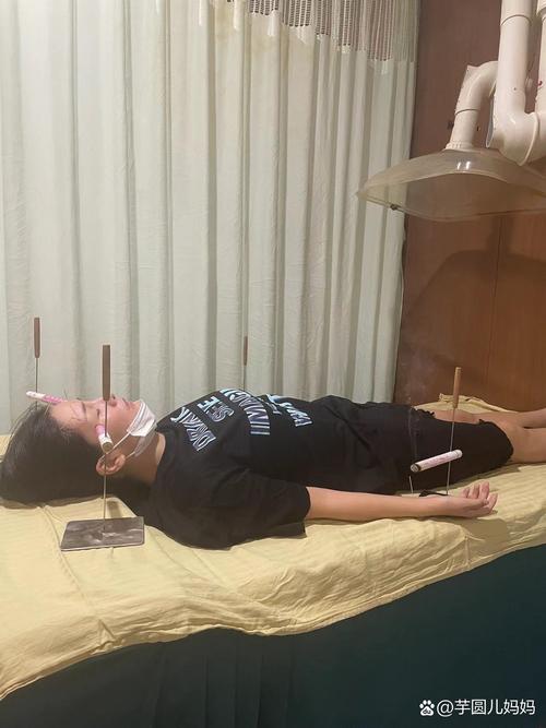 怀孕初期可以做针灸吗