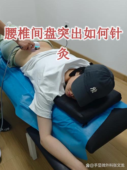 腰椎盘突出可以针灸吗