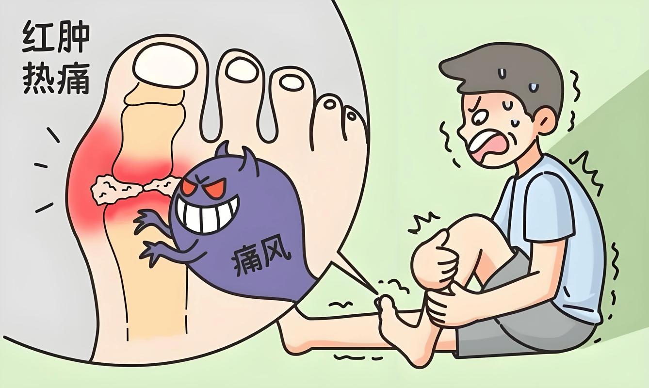 痛风性关节炎 ppt