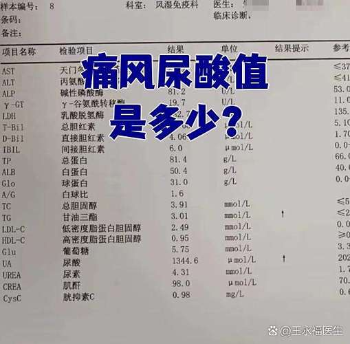 痛风患者的尿酸是多少