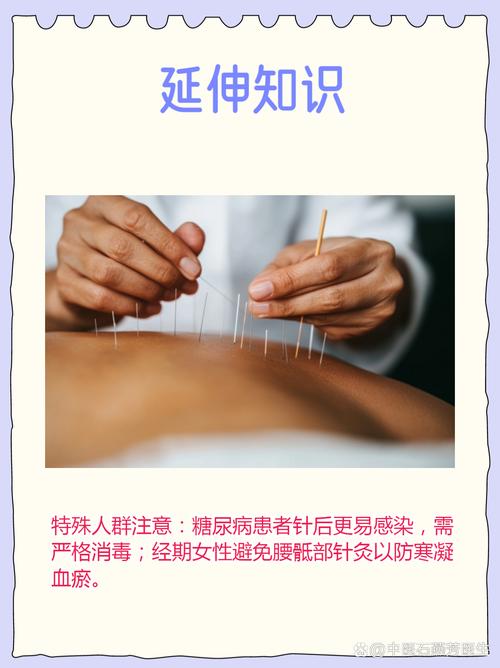 针灸后症状加重正常么