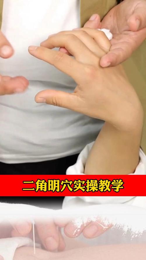 岔气针灸怎么治疗方法