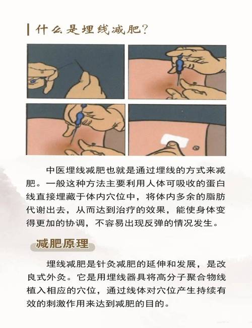 瘦针灸贴多久可以拿掉