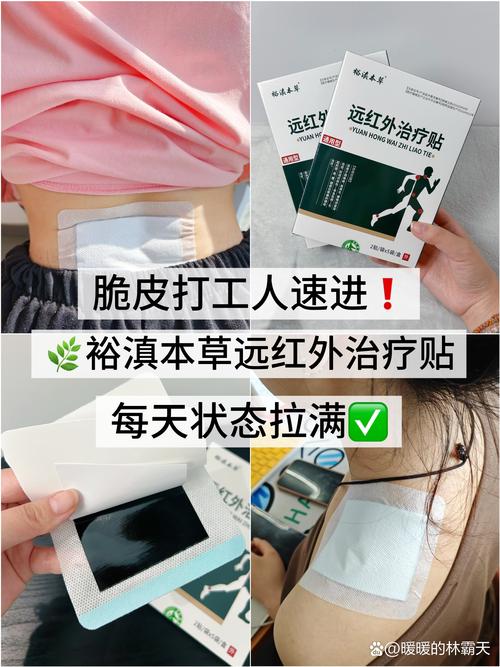 瘦针灸贴多久可以拿掉