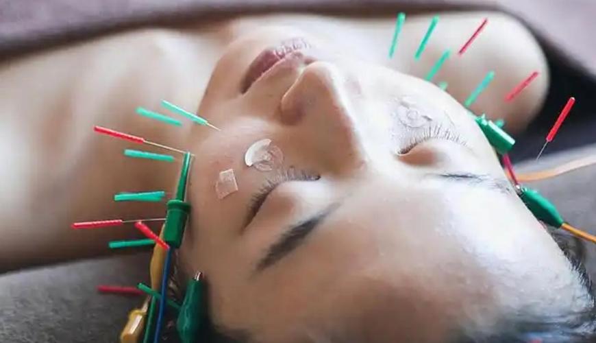 面部去皱针灸美容视频