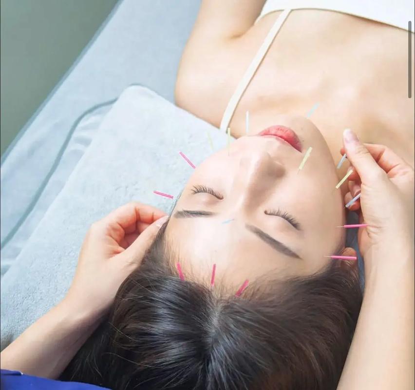 面部去皱针灸美容视频