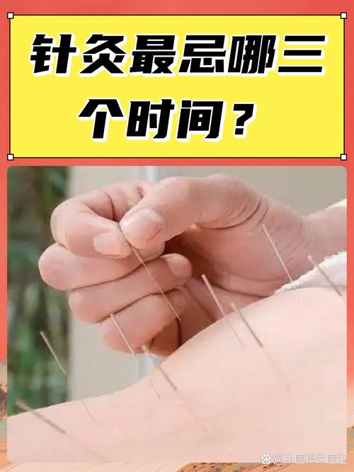 每天针灸的最佳时间是