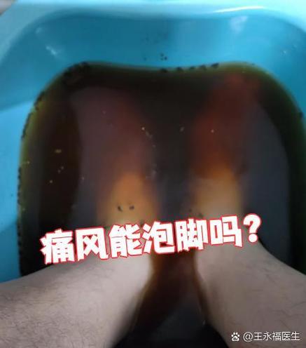 痛风脚痛风可以泡脚吗