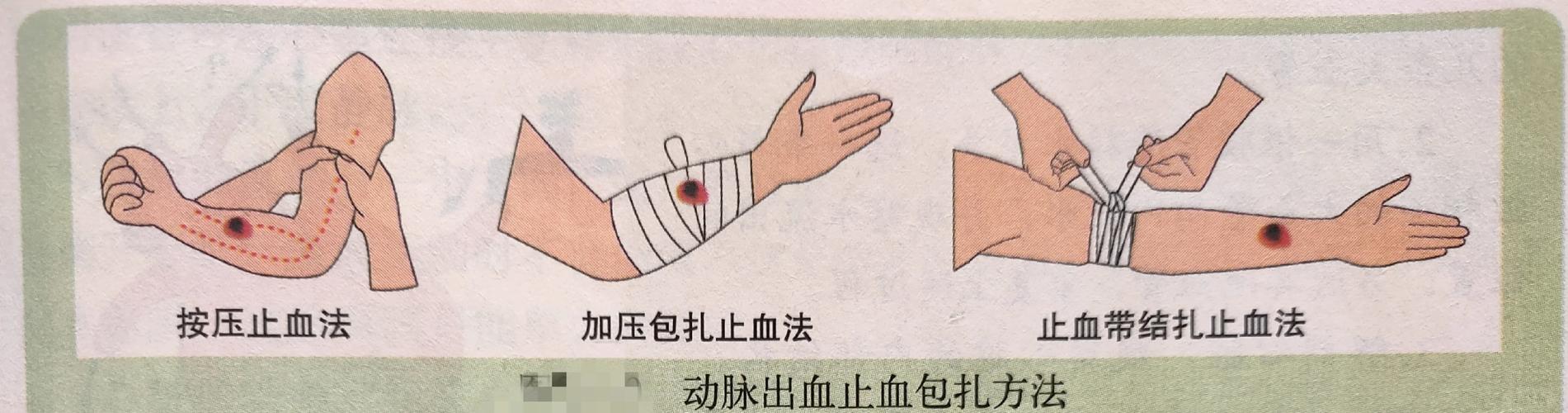 子宫出血不止针灸止血