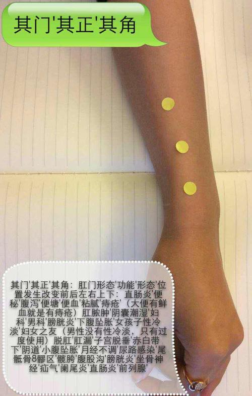 子宫出血不止针灸止血