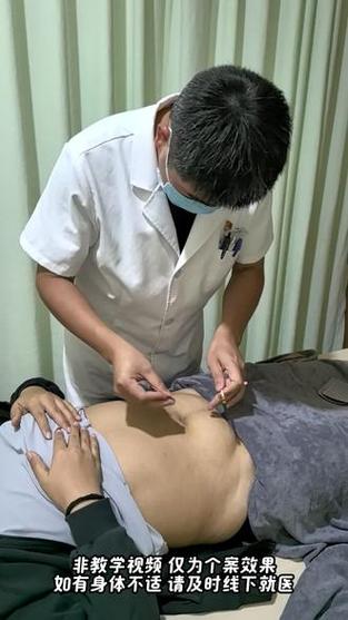 女人闭经后针灸来月经