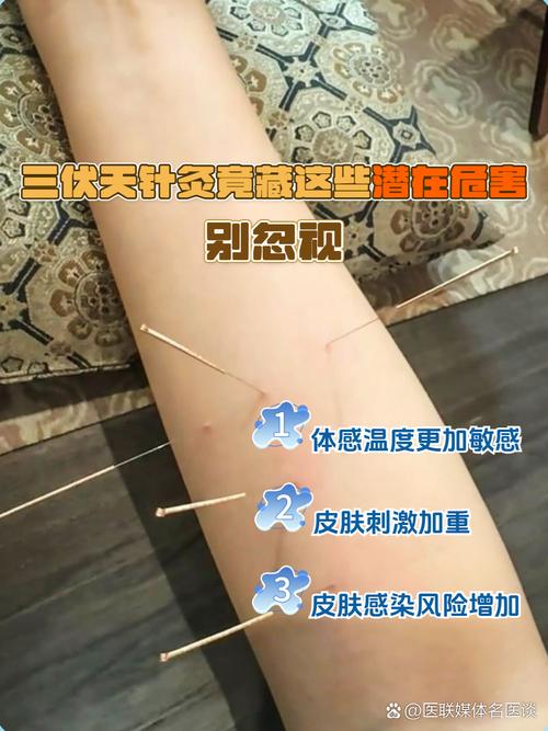 针灸治疗咽炎几天能好