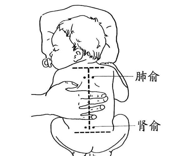 小孩发烧艾针灸灸哪里