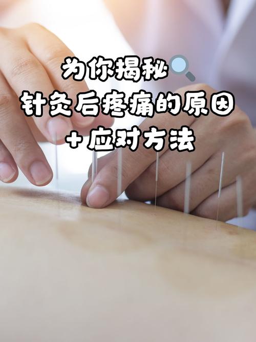 针灸后针眼疼痛正常吗