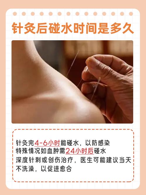 针灸后针眼疼痛正常吗