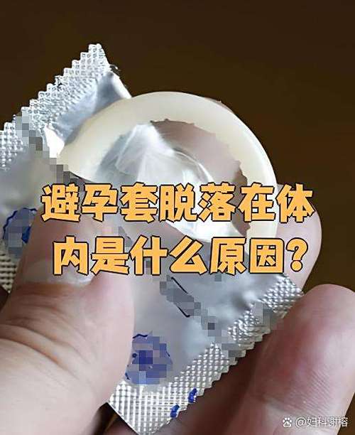 安全套掉体内有感觉么