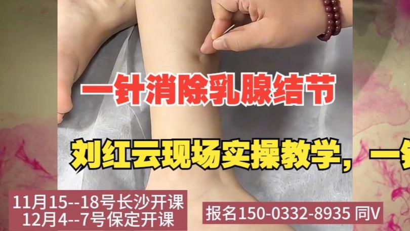 中年女性乳腺针灸视频