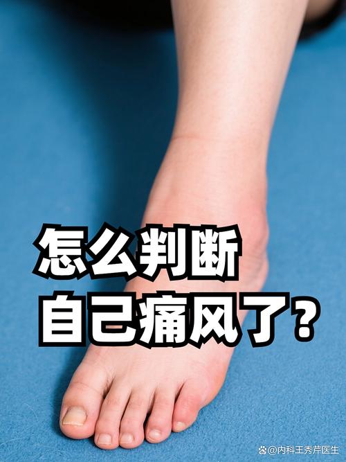 痛风的症状是哪些症状