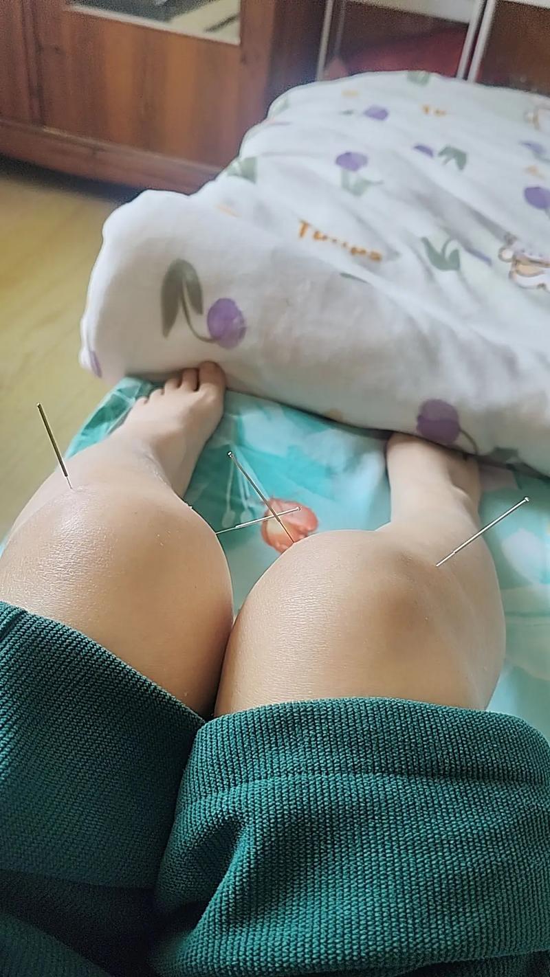 女性针灸视频大全视频