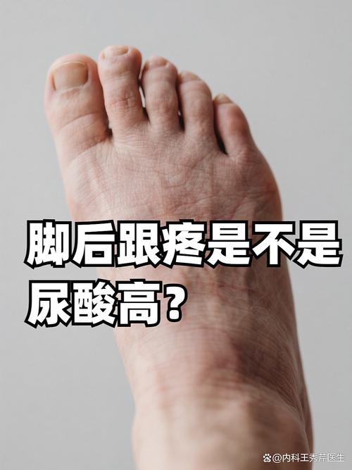 痛风会引起糖尿病足吗