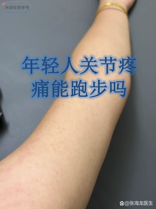 痛风性关节炎能跑步吗