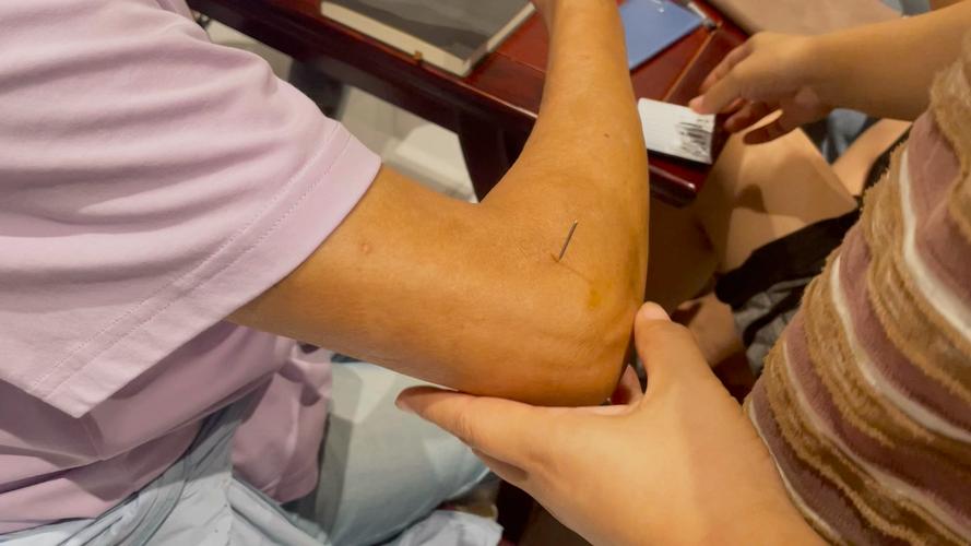 中医针灸视频教学视频