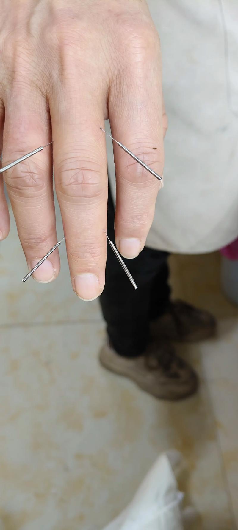 中医针灸视频教学视频