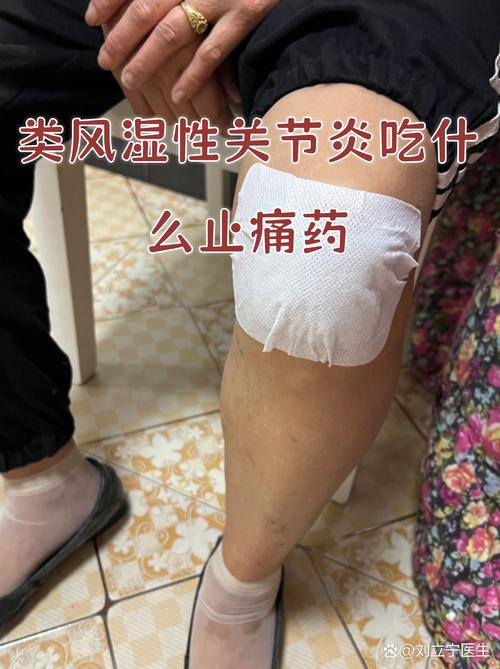 苯臭马龙治痛风怎么样