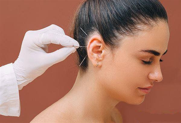 针灸能治内分泌失调吗