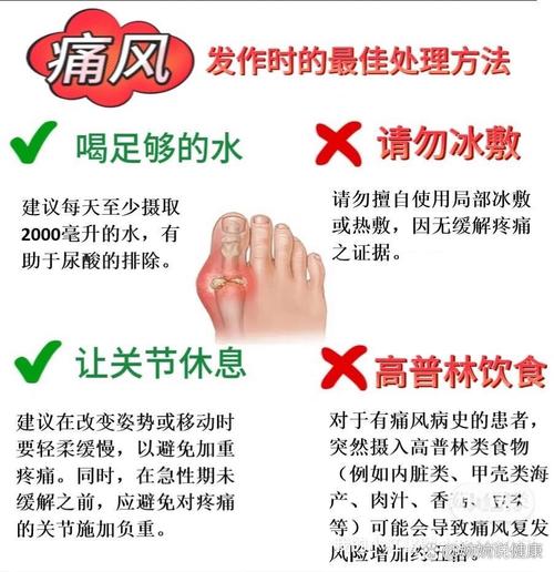 痛风发作时应如何处理