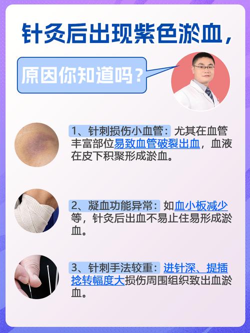 针灸后屁多是什么原因